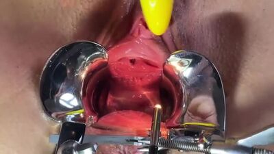 Speculum and gaping pussy 