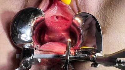 Speculum and gaping pussy 