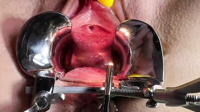 MILF Speculum closeup and orgasm