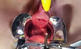 Speculum and gaping pussy 